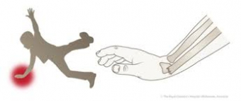 Ski Injury Spotlight: Fall On OutStretched Hand (FOOSH)