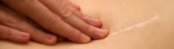 Understanding Scar Tissue & How to Help Healing