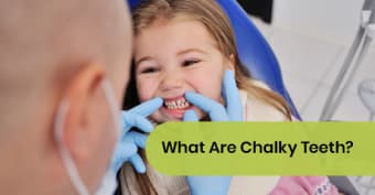 What Are Chalky Teeth?