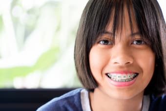 Life with Braces - What to Expect
