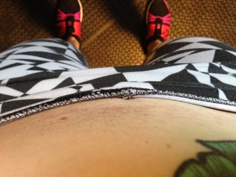 What my C-Section Scar Taught Me