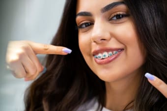 What Colour Braces Should I Get? Tips to Help You Choose