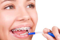 Caring For Your Braces
