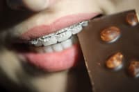 Foods To Avoid During Braces Treatment