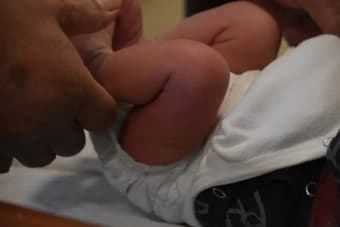Common Myths About Infant Circumcision — Debunked