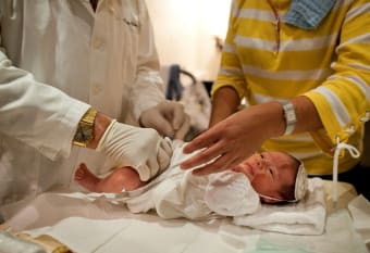 Benefits of Circumcision for Babies: Medical and Hygiene Insights