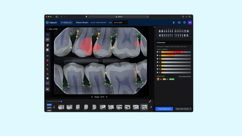 VideaHealth at Tend: Clearer, More Confident Dental Exams