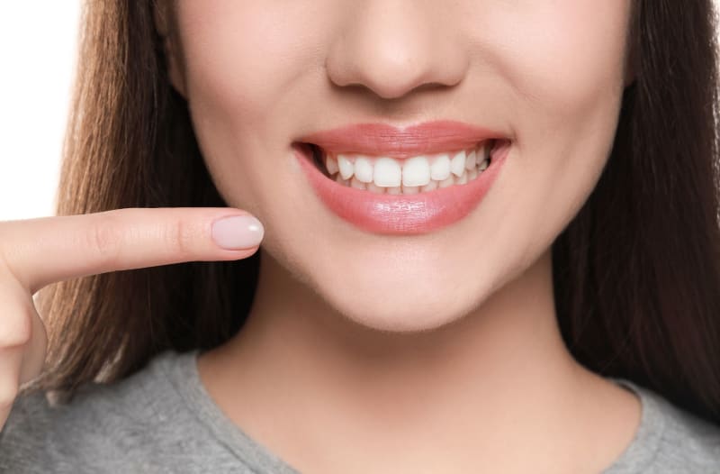 How Teeth Whitening in Maple Ridge Works Before the Holidays