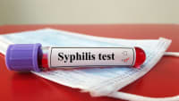 What Happens if a Syphilis Test Is Positive for Immigration?