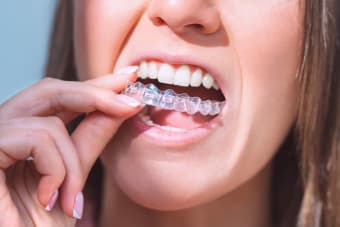 Can Invisalign fix a midline shift?