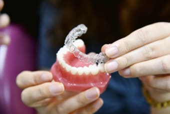 Types of Invisalign Treatments