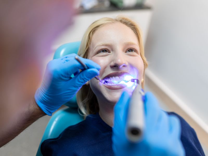 What to Expect When Bleaching Teeth at the Dentist and Why It’s Worth It