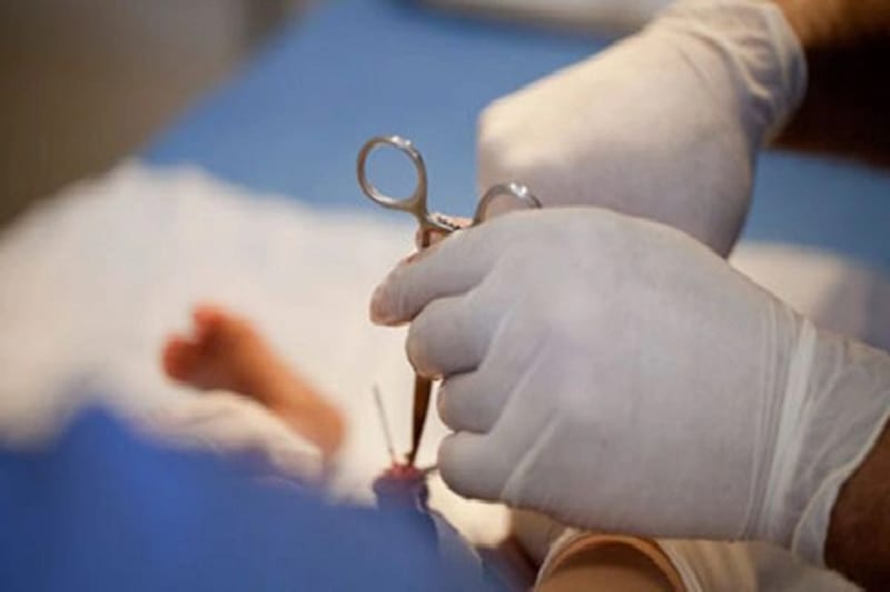 Common Misconceptions About “Painless Circumcision” (and What’s Realistic)