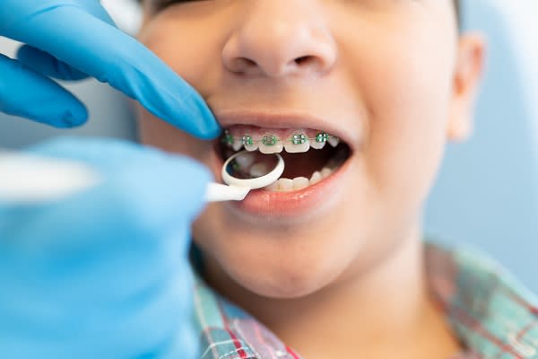 Why Children Should See an Orthodontist Before Age 7 in 2026
