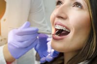 How to Effectively Clean Teeth with Orthodontics