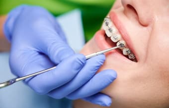 Bite Issues Explained: Overbite, Underbite, Crossbite & Treatment Options