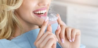 How Long Do You Have to Wear a Retainer After Braces?