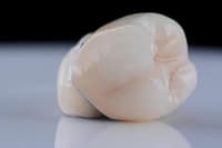 What Does a Dental Crown Look Like?