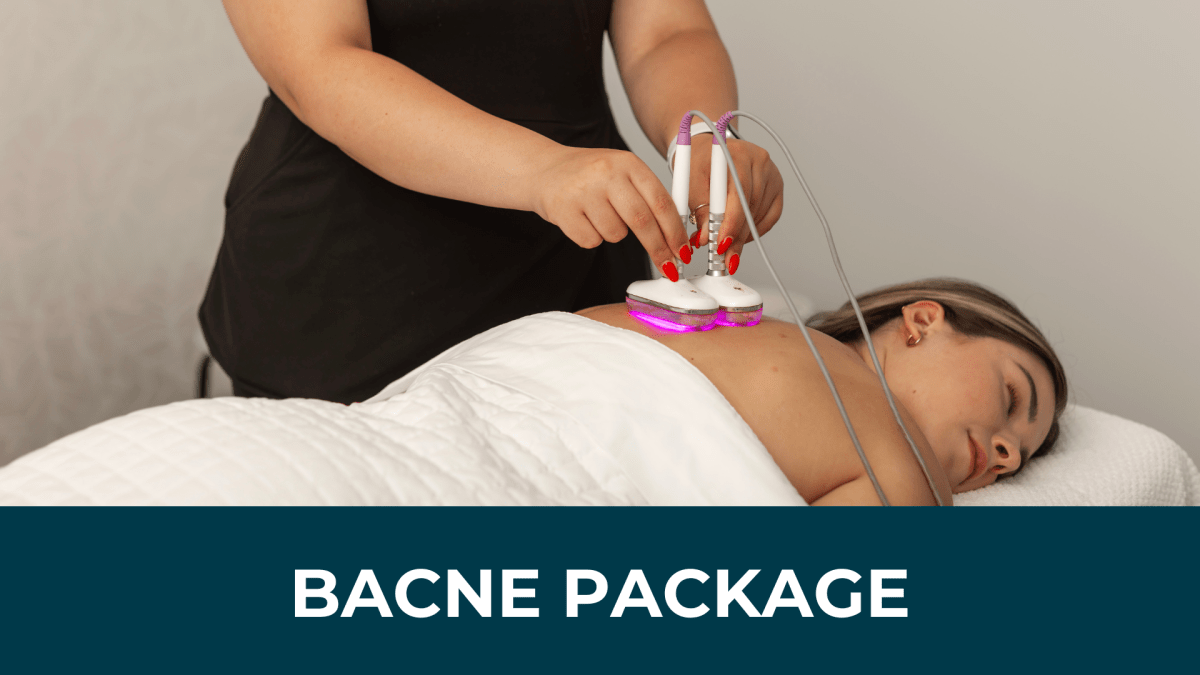 June Promotion: Bacne Package of 3