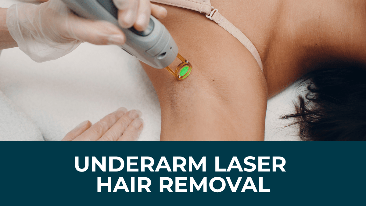 August: Underarm Laser Hair Removal Promotion