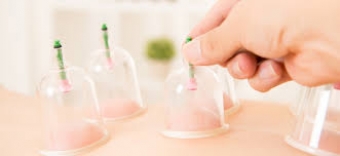 Cupping: What is it & how does it work