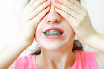 Some Facts About Orthodontic Elastics