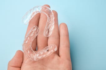 Clear Aligners & Their Value