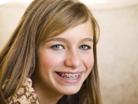 Orthodontics Options for Teens