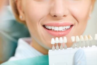 How often should I whiten my teeth?