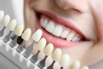 Are my teeth healthy enough for whitening?