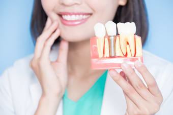 The Cost Factors of Dental Implants