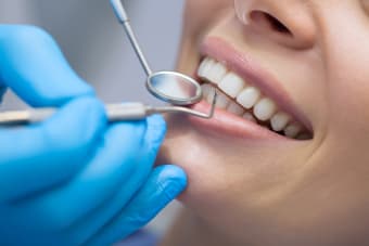 The benefits of professional dental cleaning