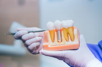 How Much Do Dental Implants Cost?