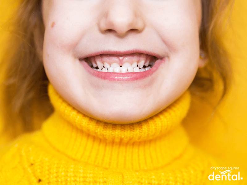 Can Braces or Invisalign Correct My Overbite? Cityscape Square Dental