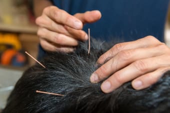 Myths and Facts About Veterinary Acupuncture